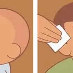 Bebé con chichón en la cabeza y niño con herida sangrante en la frente, mostrando un golpe en la cabeza niño.